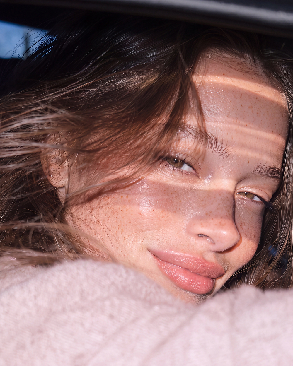 freckles sunlight closeup